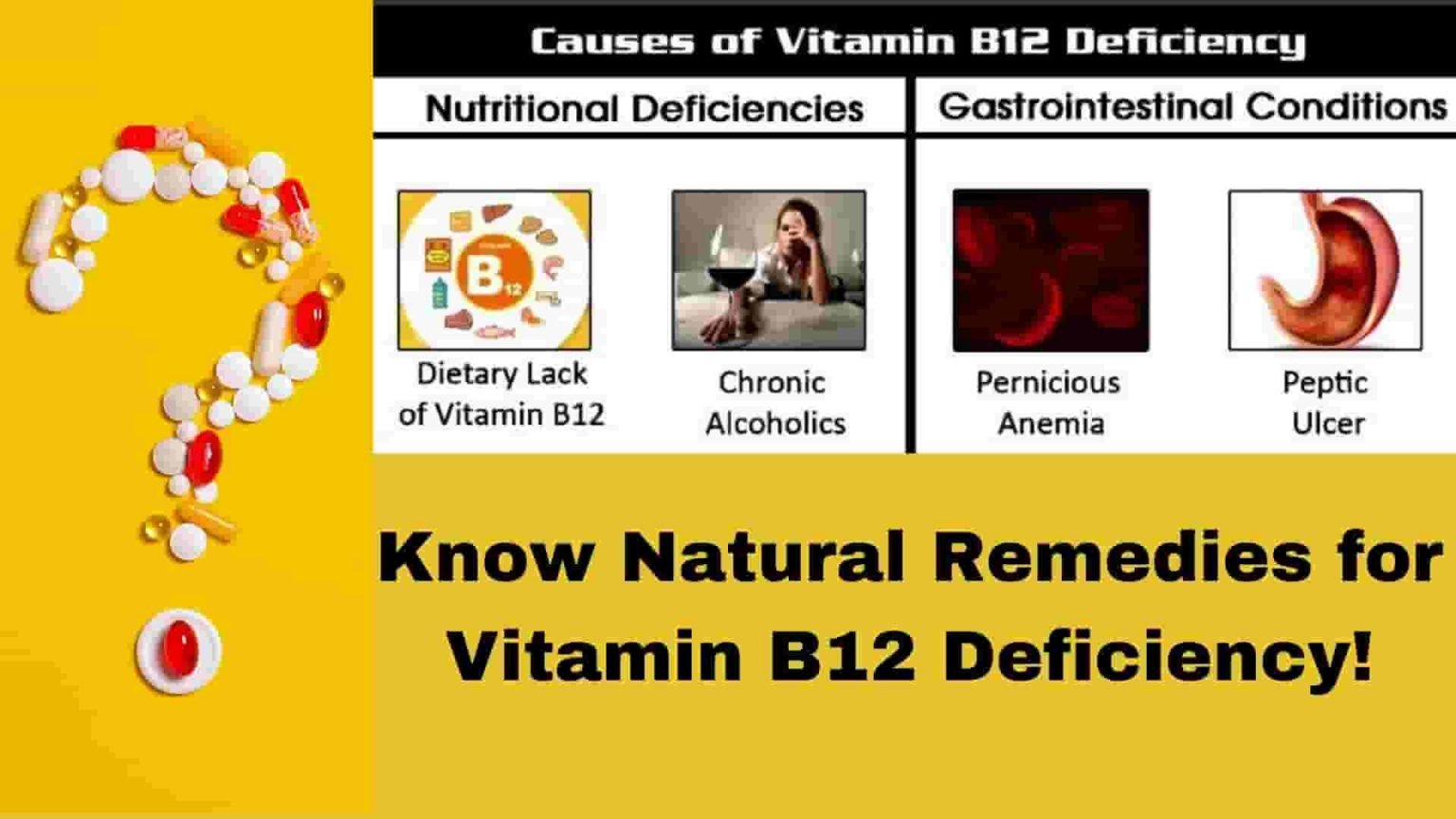 Natural Remedies for Vitamin B12 Deficiency